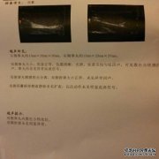 当我查看检查报告时，肾