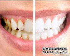 牙齿是黄色和臭的。每天